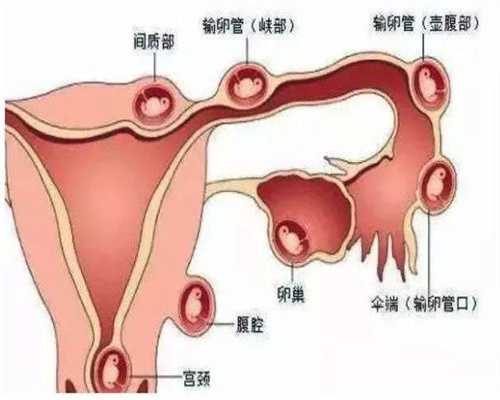 上海代孕协议-上海代孕真的合法吗-卵巢早衰上海供卵去哪里
