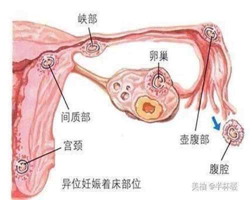 上海代孕专家_上海代孕公司合法吗_上海代孕是怎么操作的