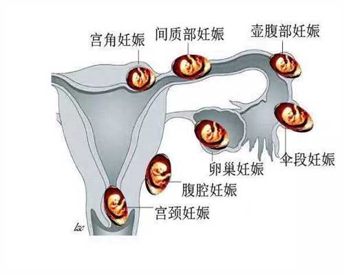 上海专业代孕机构_上海做代孕能生男孩吗【让每一个成功案例，都是坚持代孕