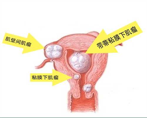 上海代孕医院-上海求助代孕-上海代孕妈妈哪里便宜