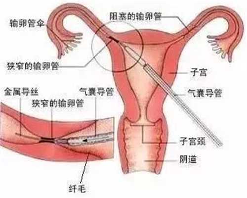 上海代孕医院_专业的代怀孕公司有哪些_代怀孕一