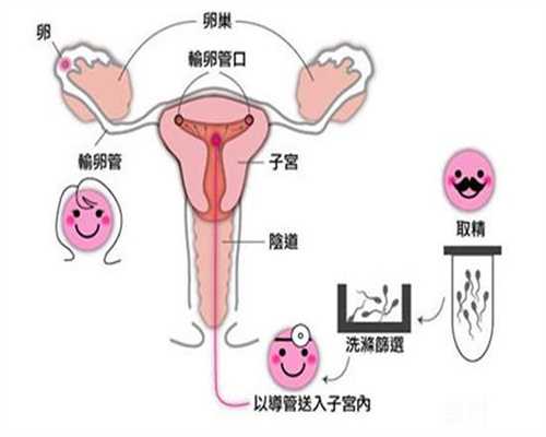 上海代孕中介_找人代孕_有没有代怀孕