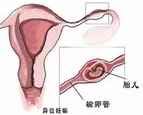 上海代孕网的流程_代孕宝宝不孕咨询_代孕儿子价格
