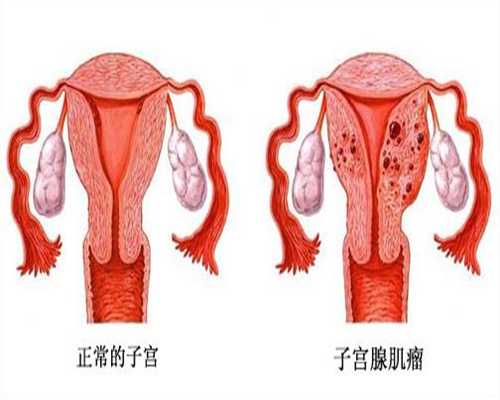 上海代孕的价格_代孕孩子的流程_代孕双胞胎免费咨询
