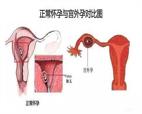 专业的代孕包性别哪里好-上海代孕孩子有别人细胞吗_【聚焦】试管婴儿，可以