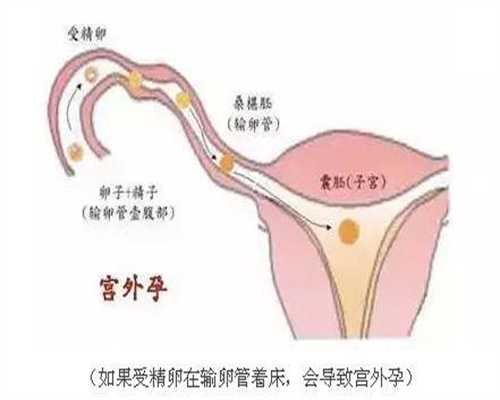 上海代孕生儿子多少钱-代孕包成功龙凤胎_高龄女性不孕需要做试管婴儿吗
