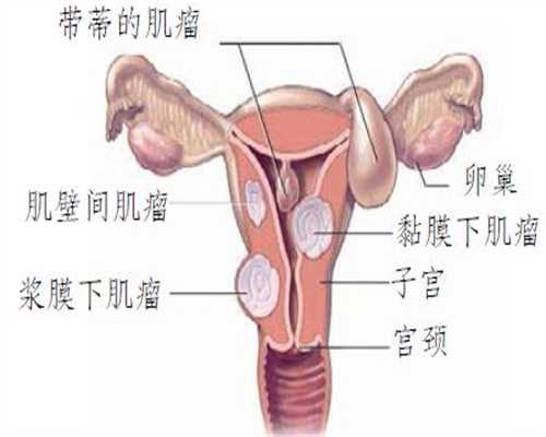 上海南方代孕网-私人代孕联系号码_子宫内膜异位症有办法通过俄罗斯试管婴儿