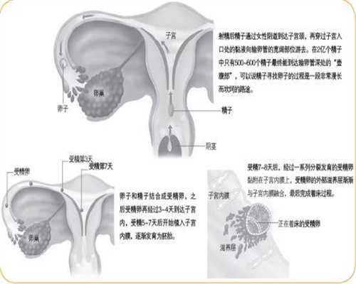 国内借腹生子多少钱-上海权威代孕医院排名_「辟谣」孕妇照胸片会导致胎儿畸